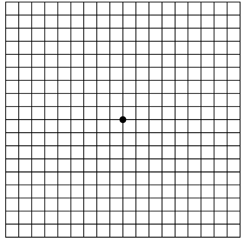 Macular Degeneration Conrad Eye Care   Macular Degeneration Test 